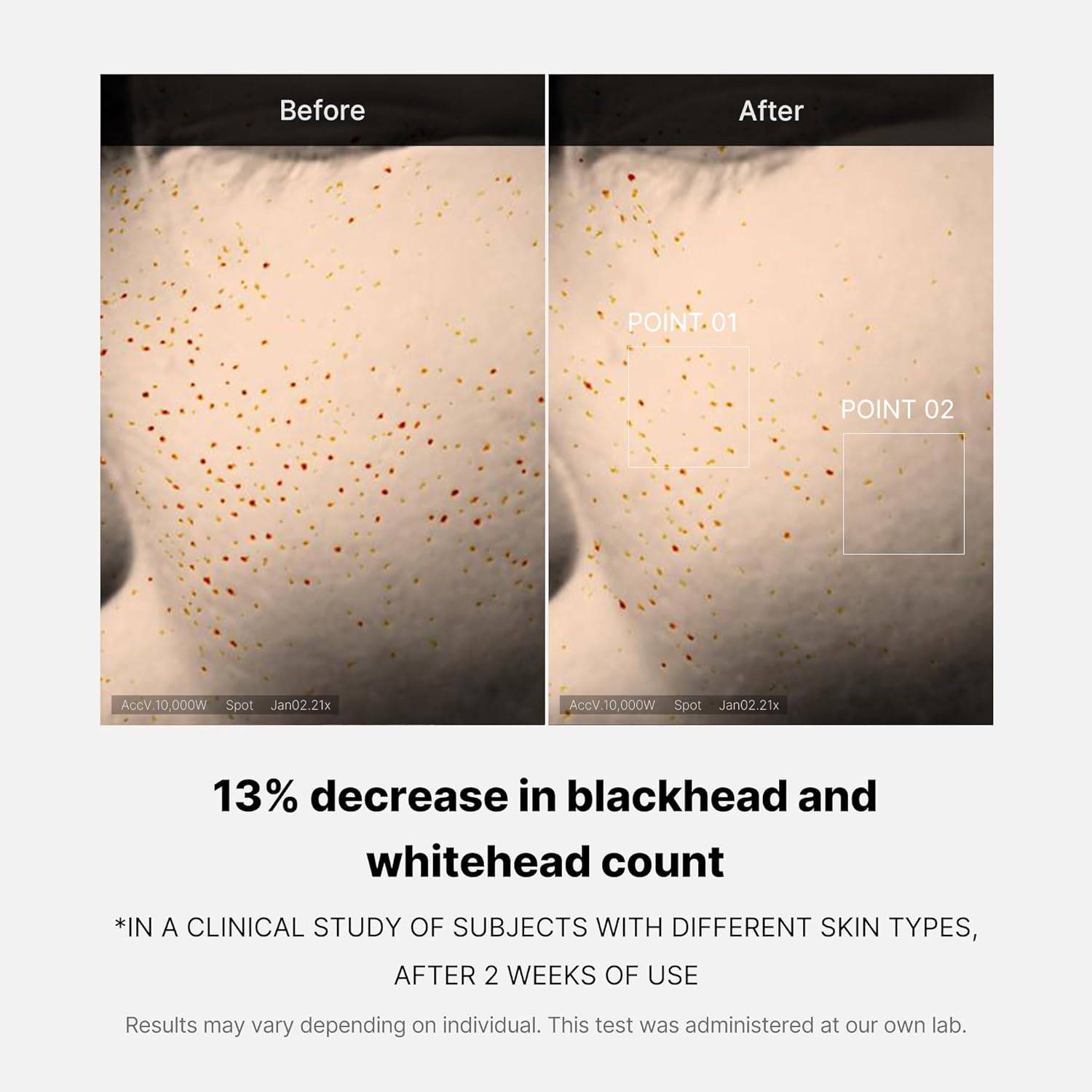 medicube ZERO PORE ONE DAY SERUM 30ml key ingredients AHA BHA PHA and niacinamide with serum texture