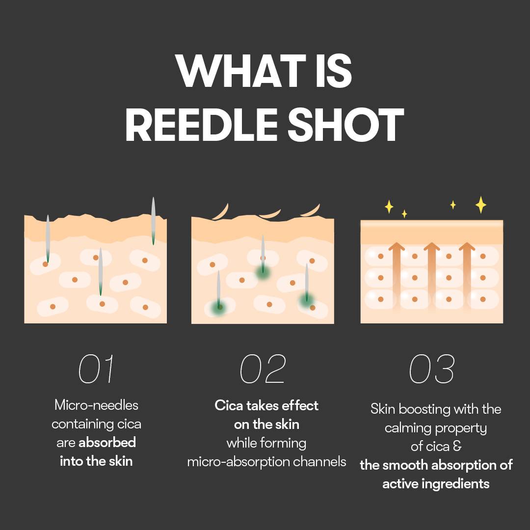 VT Reedle Shot 100 how micro-needles with cica work step by step