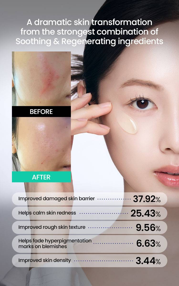 Beplain CICA PDRN Skin Booster Serum before and after results chart