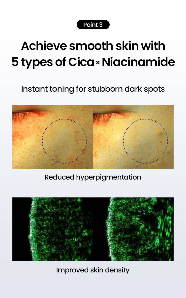 Beplain CICA PDRN Skin Booster Serum Cica and niacinamide hyperpigmentation, skin density test