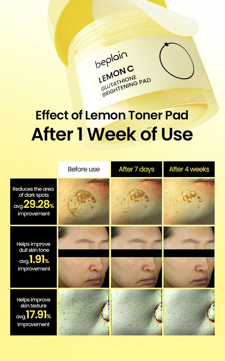 Beplain Lemon C Glutathione Brightening Pad before and after 1 week and 4 weeks results