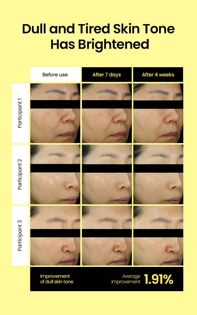 Beplain Lemon C Glutathione Brightening Pad dull skin tone before and after 3 participants