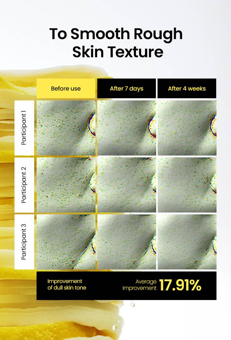 Beplain Lemon C Glutathione Brightening Pad rough skin texture before and after results