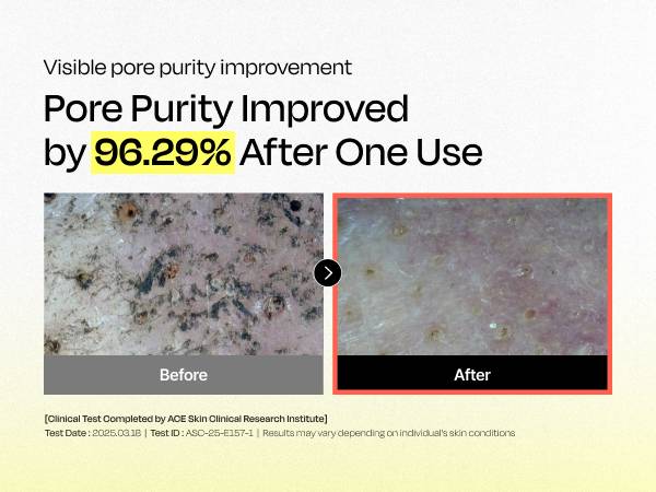 celladix 131 Pore Care BHA Cleanser pore purity clinical test before and after