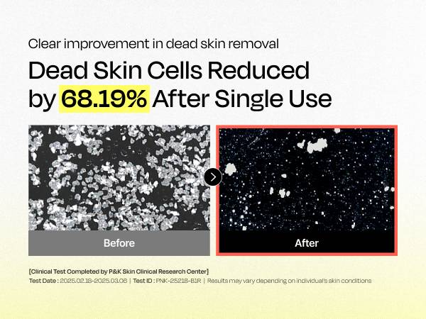 celladix 131 Pore Care BHA Cleanser dead skin cell removal before and after